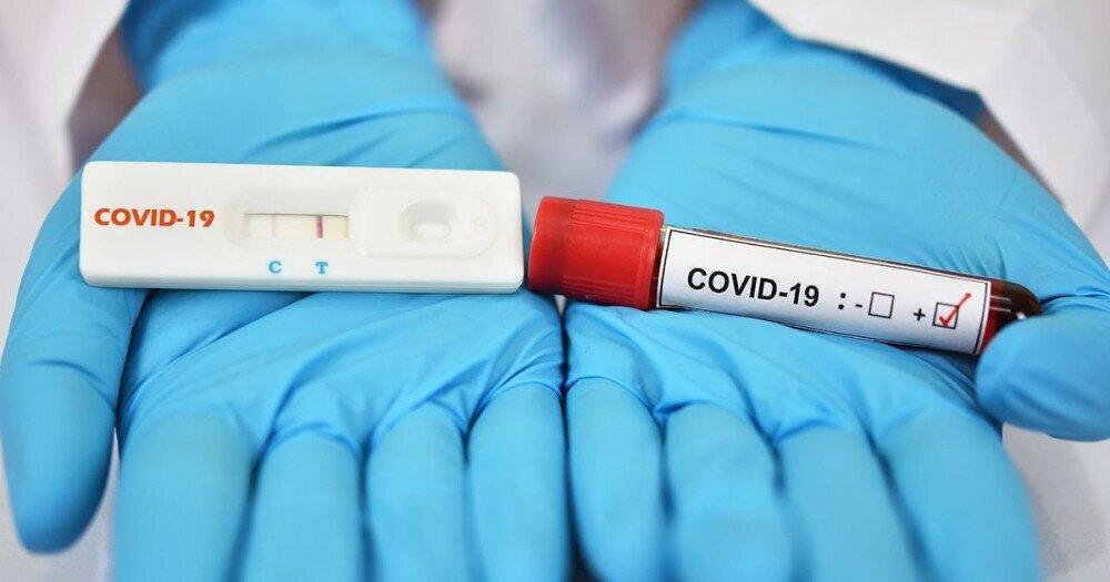 943 New Coronavirus Cases Recorded in Georgia