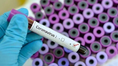 Georgia Reports 161 New Cases Of COVID-19, 1 Death - Stopcov.ge
