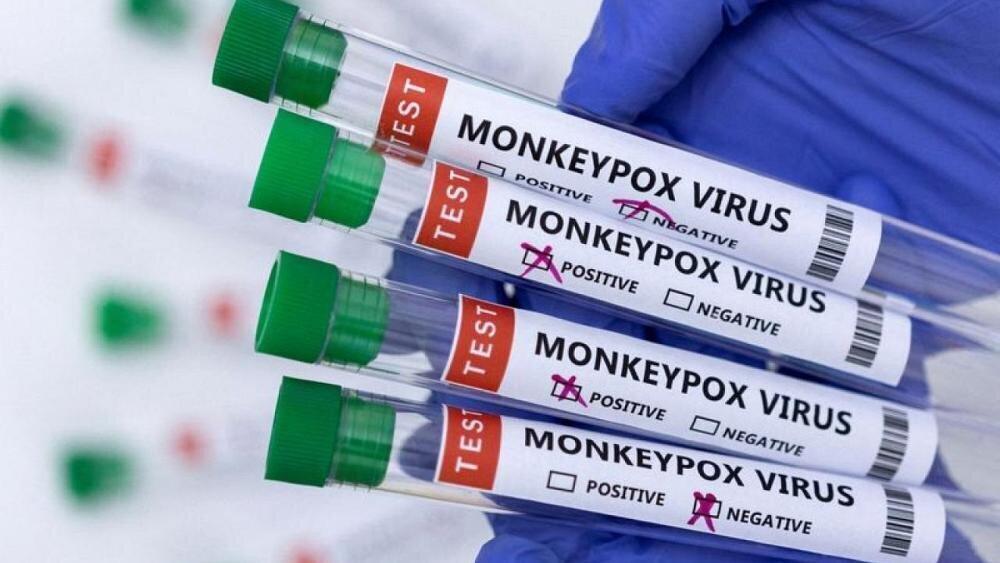 CDC raises monkeypox alert as global cases surpass 1,000